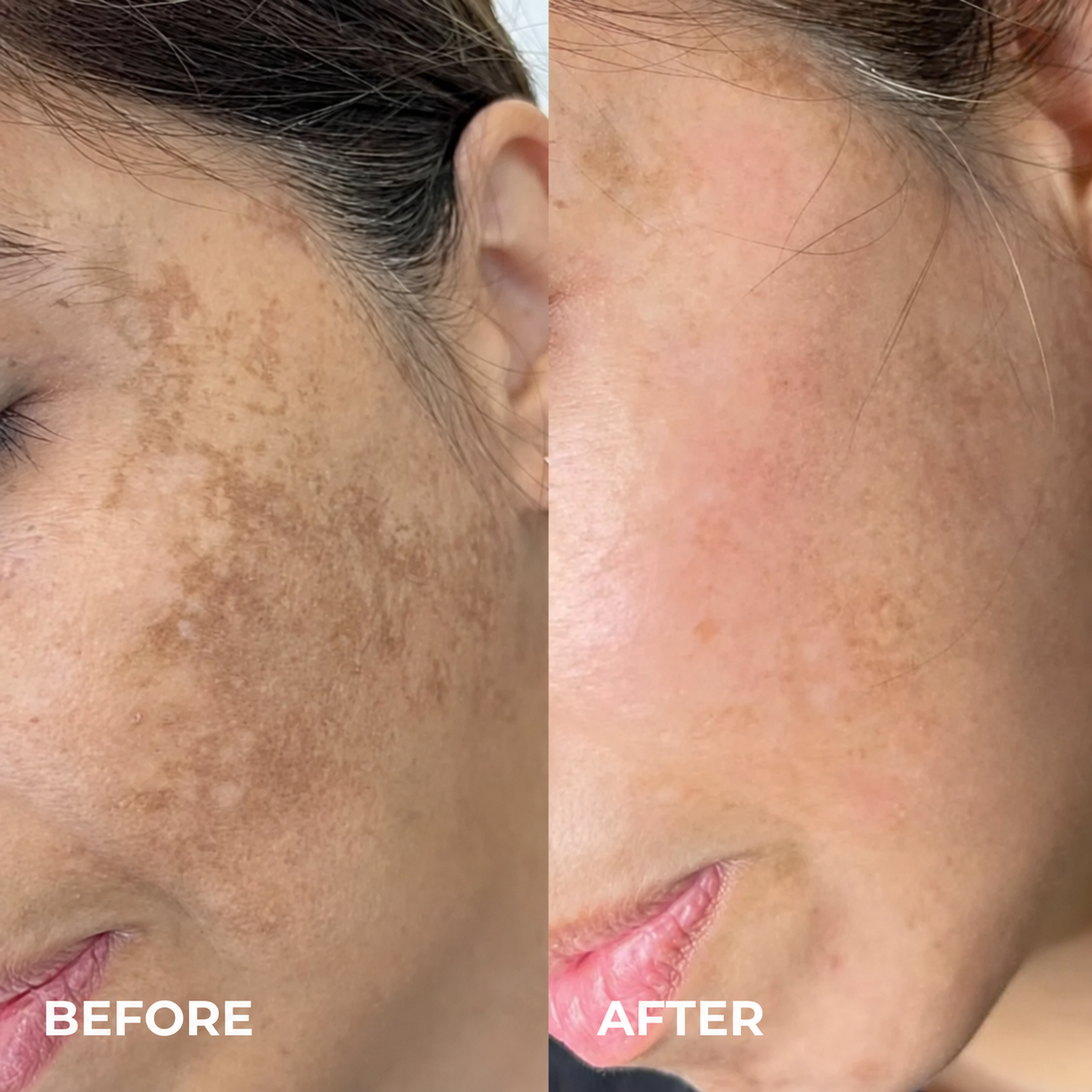 Kindral Tranexamic Brightening Cream