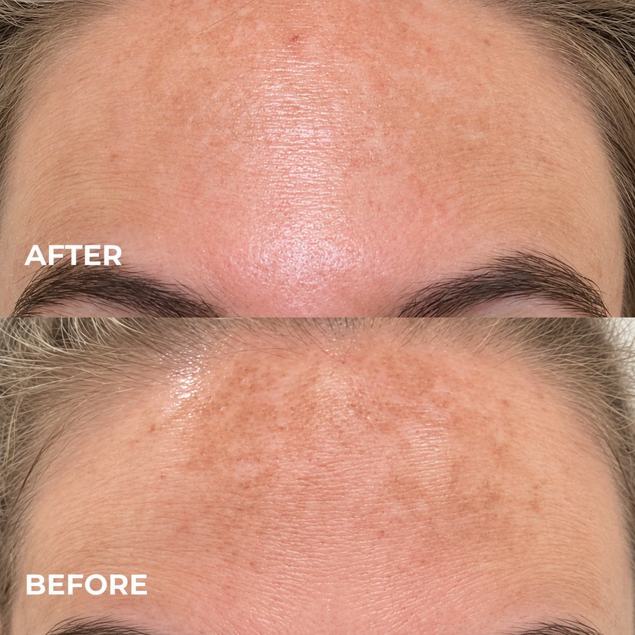 Kindral Tranexamic Brightening Cream