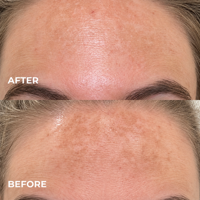 Kindral Tranexamic Brightening Cream