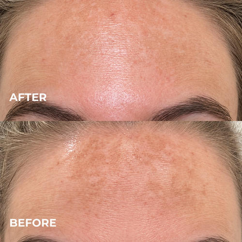 Kindral Tranexamic Brightening Cream