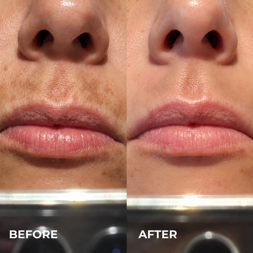 Kindral Tranexamic Brightening Cream
