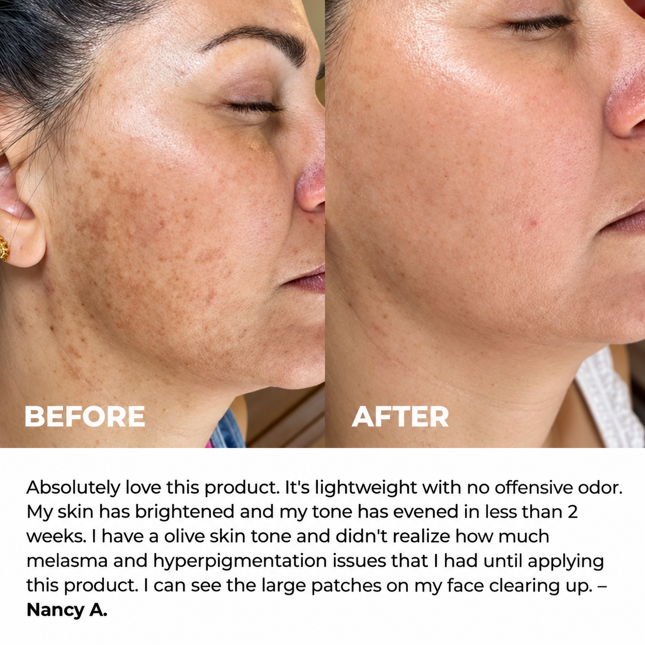 Kindral Tranexamic Brightening Cream