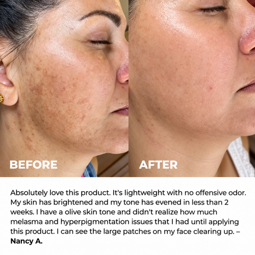 Kindral Tranexamic Brightening Cream